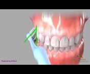 AvA Orthodontics u0026 Invisalign