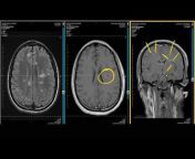 MRI Online Powered by Medality