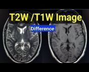 ADVANCE MRI SCAN Technique