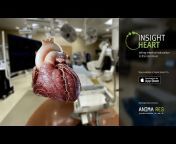 ANIMA RES - 3d medical animation