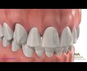 AvA Orthodontics u0026 Invisalign