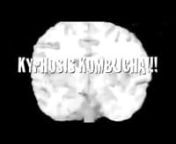 kyphosis kombucha means hunchback kombucha in medical. gods make it we drink it. written by wikler, israel, jauss, shavel, batra, hartley, cullen, klazen, doyle. featuring otey &amp; shere as