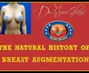 In these serious pictures of one patient who has breast augmentation, I want to show you how the breast implant essentially progress from the day of surgery all the way to when the patient has recovered.Many times when you perform this procedure, the breast implants tend to ride high and you going to feel like you breasts are distorted, it feels tight, the breast does not look round, and it looks misshaped so in this first picture you see that after the first week of the breast augmentation no