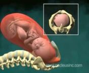 El parto vaginal en imágenes animación 3D (coronamiento) from parto vaginal