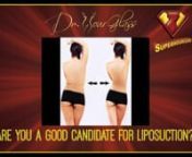 Liposuction is a surgical procedure that removes pockets of excessive fat from stubborn areas to create a better and more aesthetically pleasing silhouette.These areas include the abdomen, the back, the face, neck, the legs, the hips, and other areas of the body with localized fat deposits. The goal of liposuction is to improve the appearance and fix body imperfections of any given anatomical area. However, it is not for everyone. nnTo be a candidate for liposuction, you need to have certain c