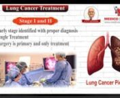 In this video, Dr. Ramakant Deshpande explaining How does doctor decide Lung cancer treatment for different stages of Lung cancer.nnLung cancer and its adversities can be lethal, if remains undiagnosed or left untreated. A multidisciplinary approach can successfully eliminate the cancer from lungs and patient may resume normal life after recovery, nsays Dr. Ramakant Dehspande, Chief of Thoracic Surgical Oncology, Asian Institute of Oncology.nnLung cancernThere are different sizes and stages of l