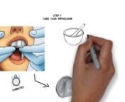 Overview of the DIY Dentures Denturi kit