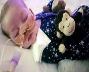 Pope Francis and US President Donald Trump have paid attention to the fate of terminally ill infant, Charlie Gard.