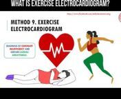 What is exercise electrocardiogram?&#60;br/&#62;This research method allows you to study the state of the heart during exercise and at rest.&#60;br/&#62;The method is practiced at rest and after exercise.&#60;br/&#62;The patient pedals on a bicycle or moves on a treadmill.&#60;br/&#62;This research method allows you to identify coronary insufficiency and some cardiac arrhythmias.&#60;br/&#62;&#60;br/&#62;#electrocardiogram #health #Exerciseecg #Exerciseelectrocardiography #Heart #Heartinvestigation #ecg #ekg #electrocardiography #exercises #coronaryinsufficiency #cardiacarrhythmia
