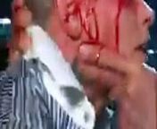 The Rock made Cody Rhodes bleed on WWE RAW 25 March 2024 Show from wwe sebel