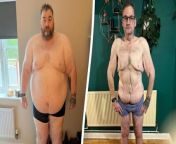 A man who lost a staggering 24 stone has told how he now faces paying £40k to have his excess skin removed because the NHS won&#39;t fund the op.&#60;br/&#62;&#60;br/&#62;Wayne Shepherd, 41, had gastric sleeve surgery which helped him shed 24 stone - dropping from his heaviest at 35 stone (226.8kg) to 11 stone today (72.4kg).&#60;br/&#62;&#60;br/&#62;The operation involves removing 80 per cent of the stomach to restrict the amount of food you can eat in one sitting.&#60;br/&#62;&#60;br/&#62;However, after the operation Wayne was told he did not qualify to have his excess skin removed on the NHS. &#60;br/&#62;&#60;br/&#62;Now he faces paying out £40k to go a private provider for the body contouring procedure on his arms, legs and chest.